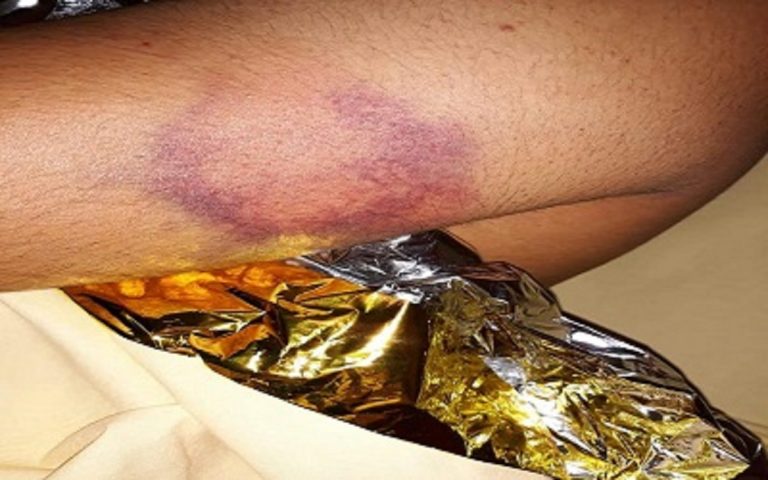 operai aggrediti a Prato