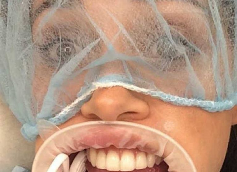 Belen Rodriguez dal dentista, lo scatto imbarazzante
