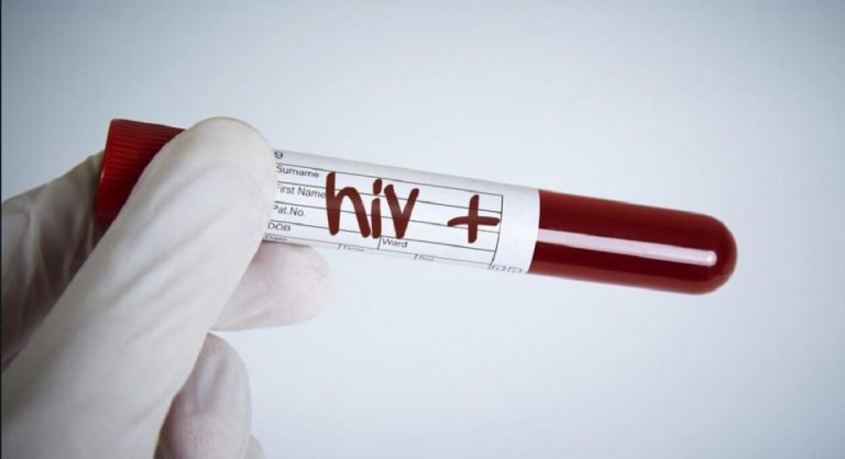 hiv