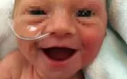 Il sorriso della bambina nata prematura che ha conquistato il web