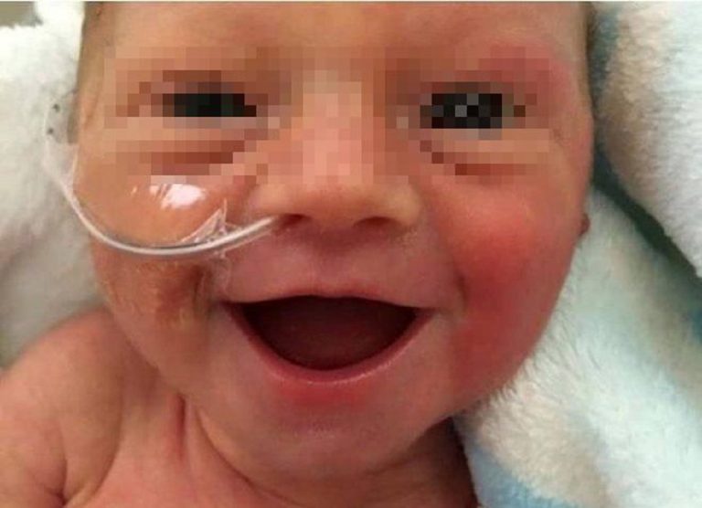 Il sorriso della bambina nata prematura che ha conquistato il web