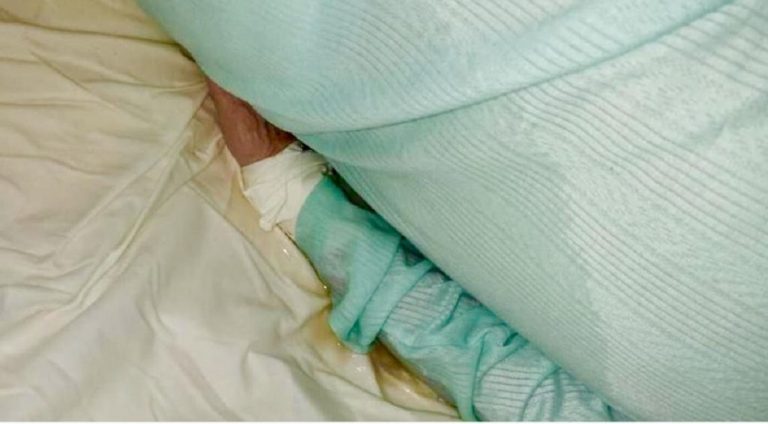 Ospedale di Caserta: anziana legata al letto tra sangue e urina