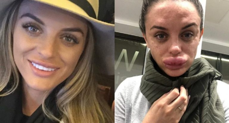 rachael 768x413