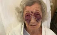 Anziana sopravvissuta all'Olocausto picchiata sul bus