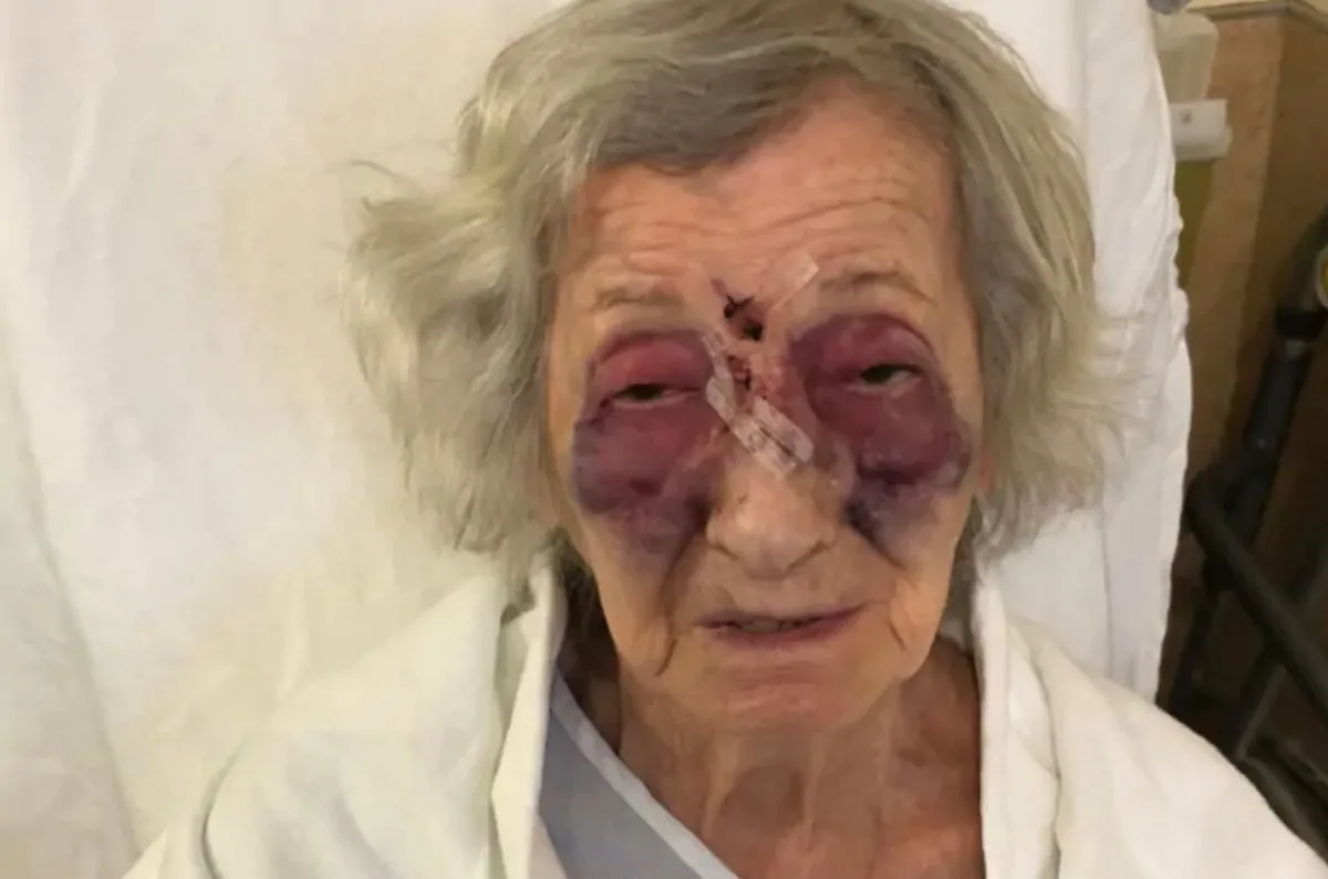 Anziana sopravvissuta all'Olocausto picchiata sul bus