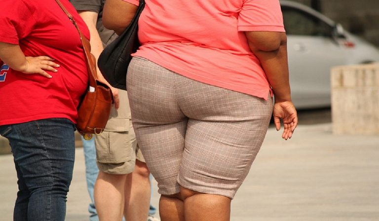 donna obesa