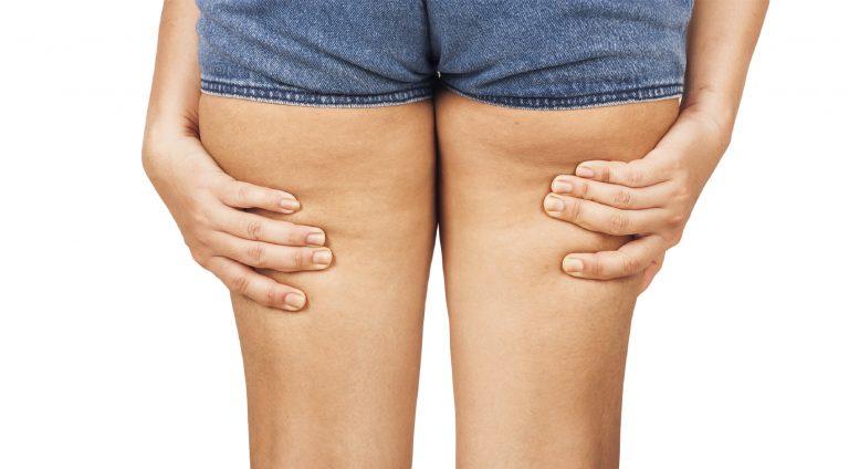 Come eliminare la cellulite.