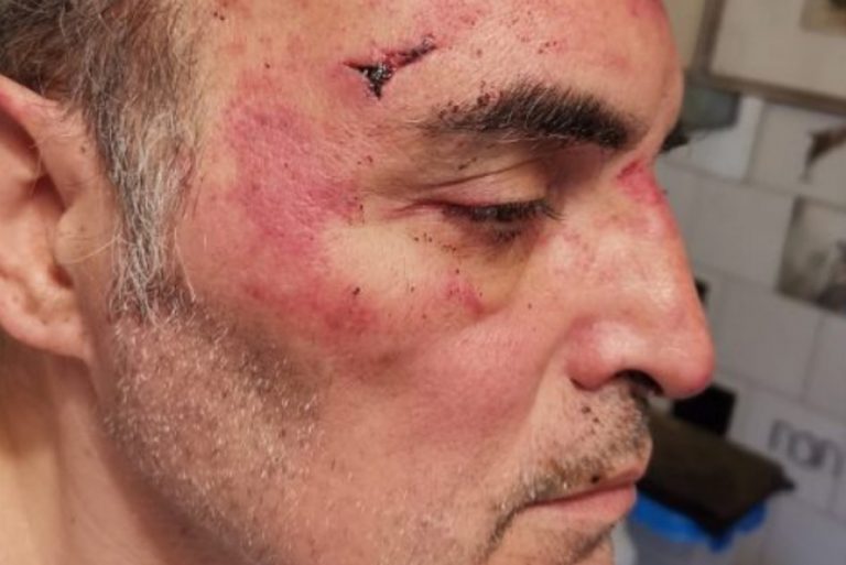 Torino, gay malmenato dai vicini di casa