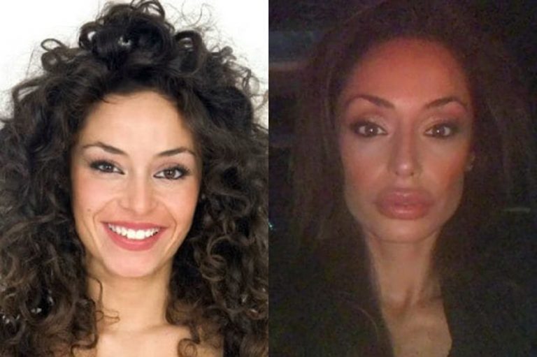 Raffaella Fico prima e dopo