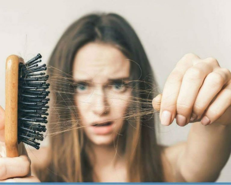 capelli diradati 768x615