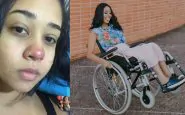 Brasile, si fa un piercing al naso e rimane paralizzata: la storia di Layane Dias