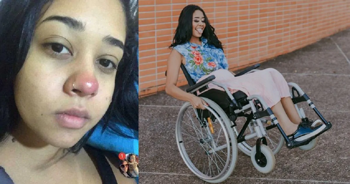 Brasile, si fa un piercing al naso e rimane paralizzata: la storia di Layane Dias