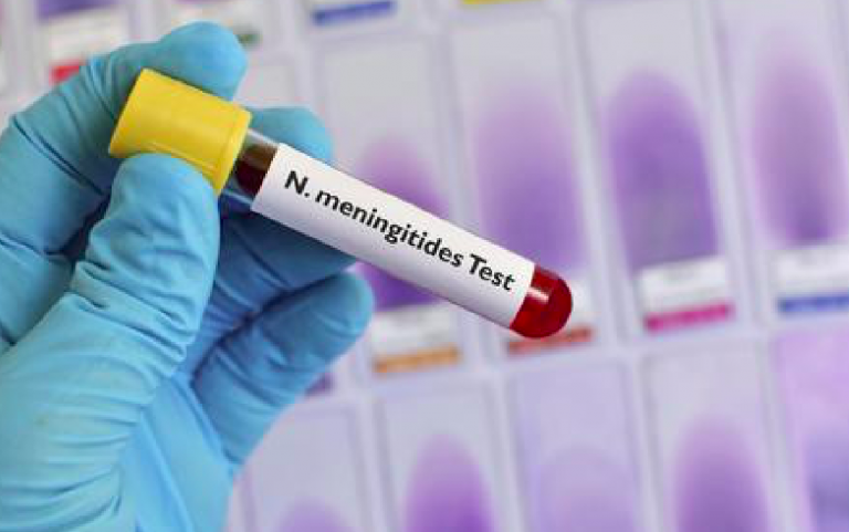 Morto di meningite, nessuna colpa medica