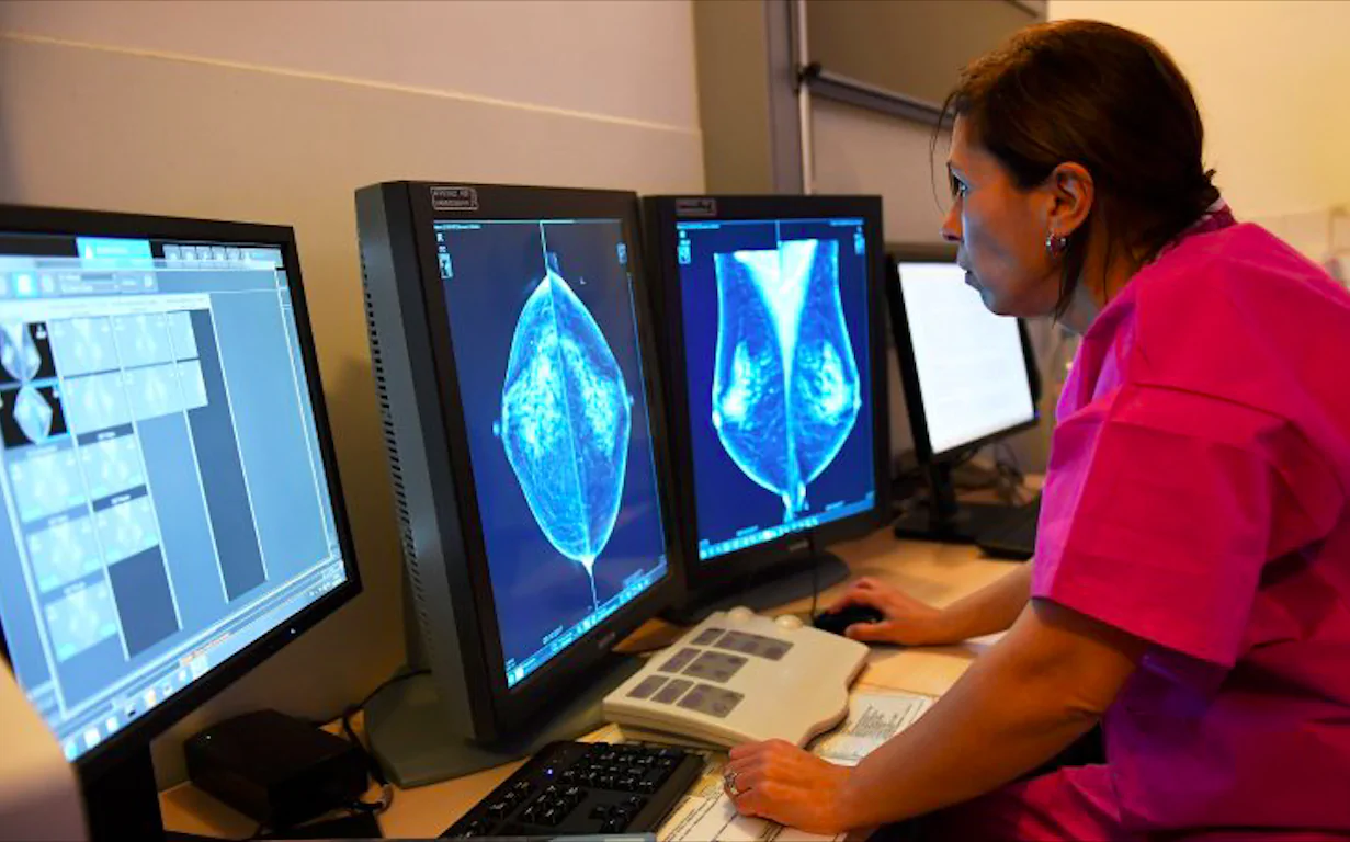 Tumore al seno, i geni che predicono il rischio di metastasi