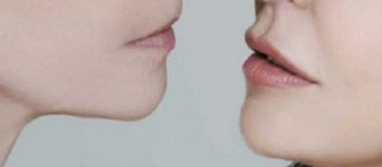 bacio saffico