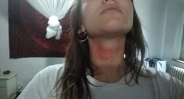 minacciata dalla polizia