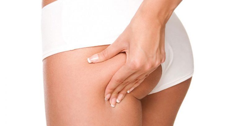 cellulite compatta