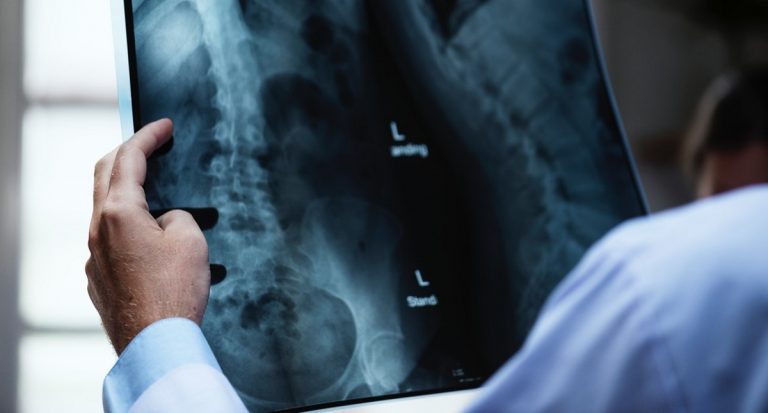 radiografia