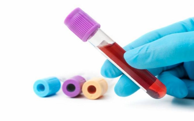 analisi sangue tumori