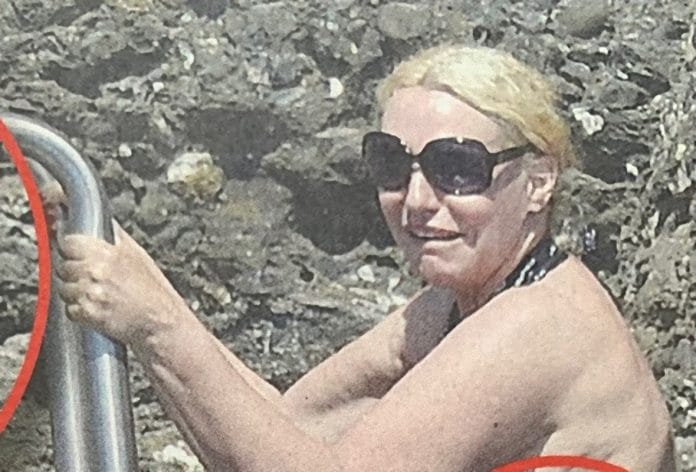 antonella clerici cellulite