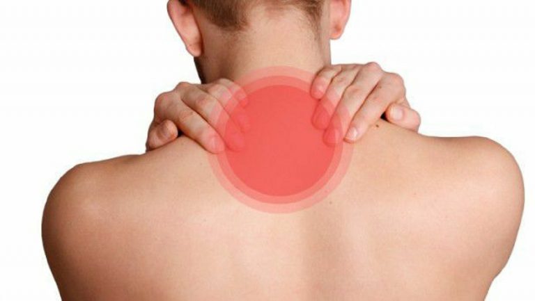 ernia cervicale: sintomi, cause, cura
