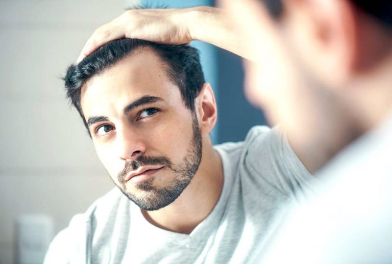 Trapianto di capelli.
