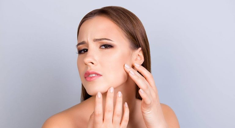 dermatite al viso: i rimedi naturali