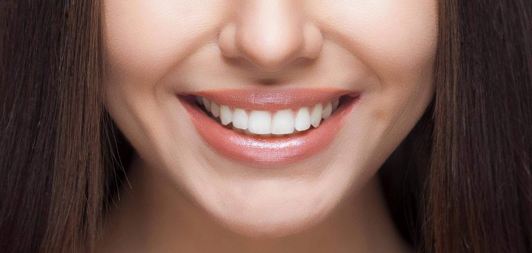 Come avere denti bianchi a casa.