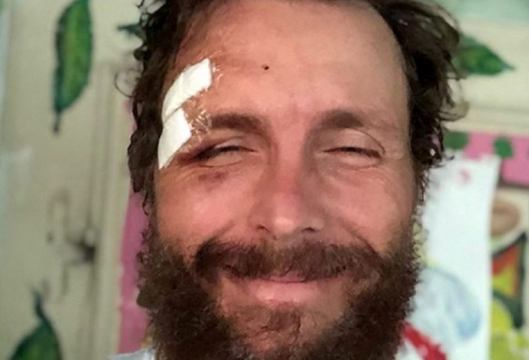 incidente jovanotti