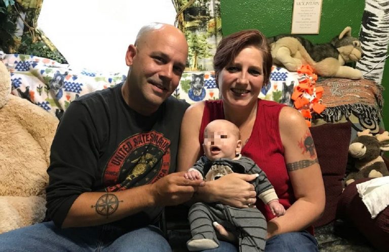 bimbo nasce con malattia rara