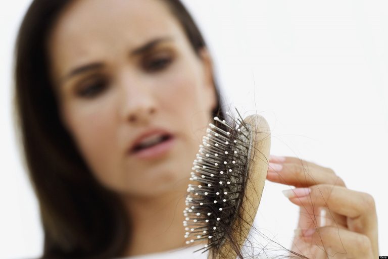 Alopecia da stress.