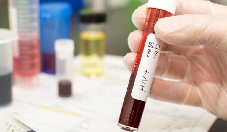 Contagia con virus hiv