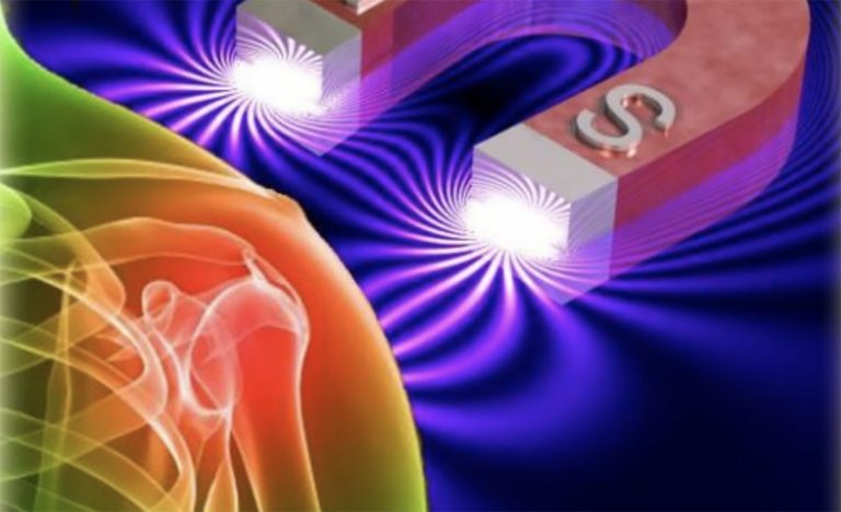 magnetoterapia