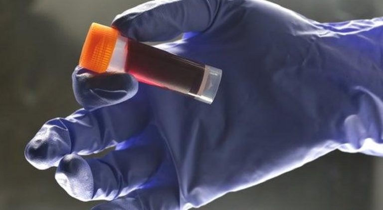 nuovo ceppo HIV