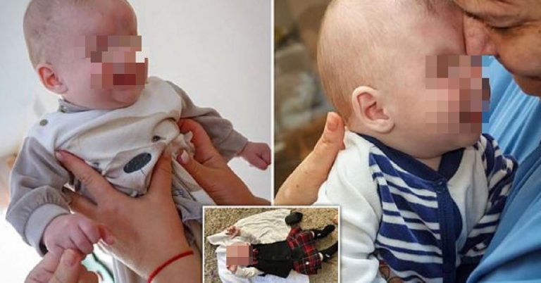 bambino senza occhi_censored
