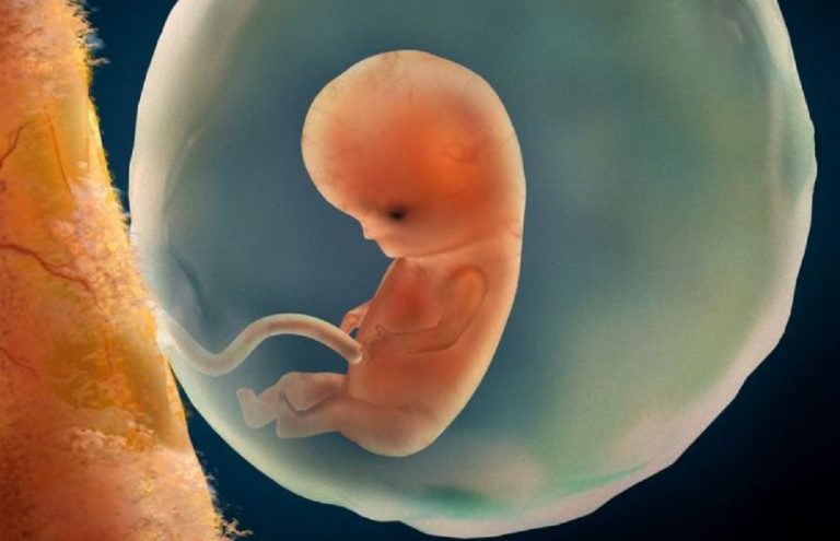 neonata partorisce il suo gemello