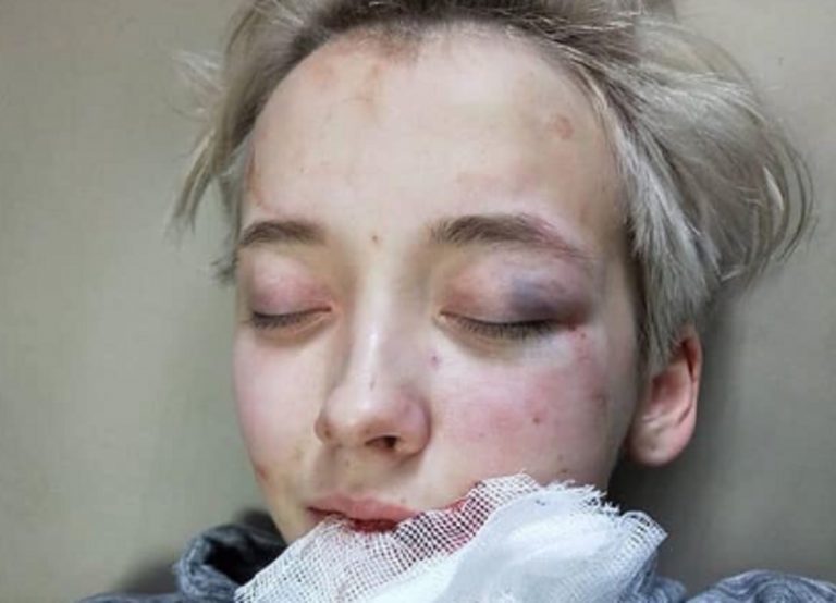 ragazza picchiata russia
