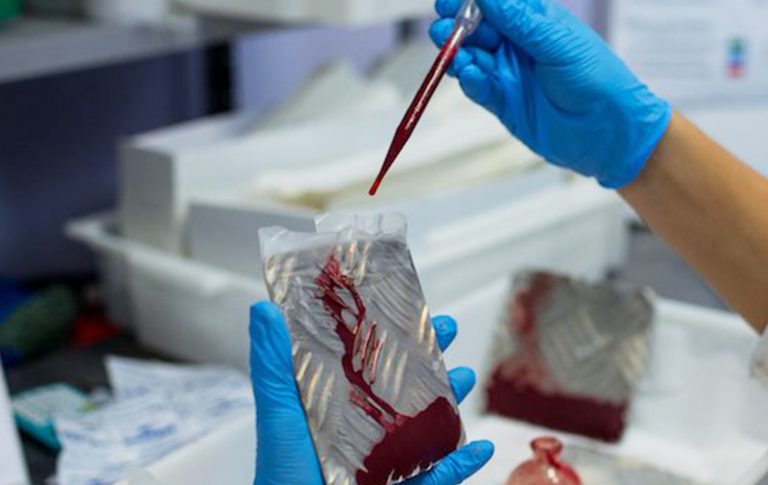 studentessa-hiv-laboratorio
