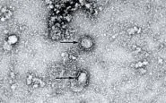 Particelle del coronavirus 2019-nCoV