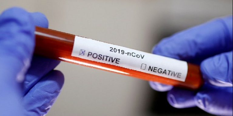 Tasso di mortalità da Coronavirus: i dati
