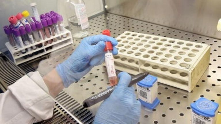 Coronavirus Italia perchè