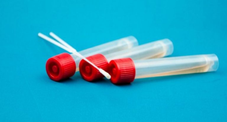 coronavirus tampone come fare