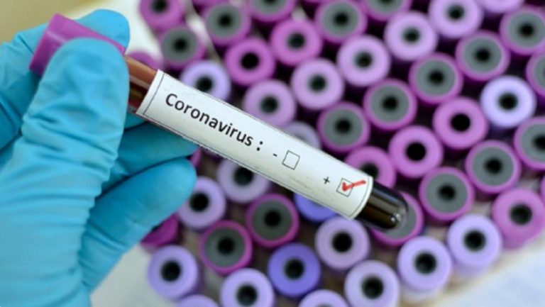 Coronavirus blocco 3 aprile