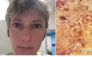 Coronavirus Lecco turni pizze