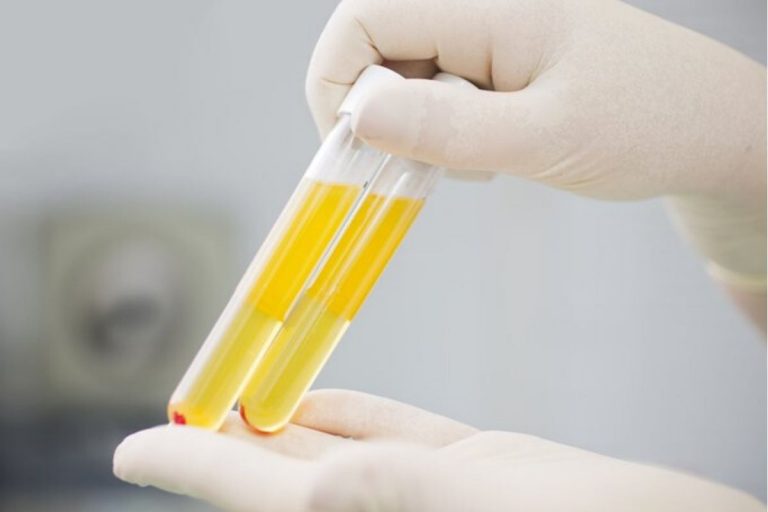 coronavirus pavia plasma
