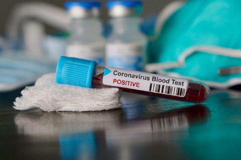 coronavirus roma prima vittima