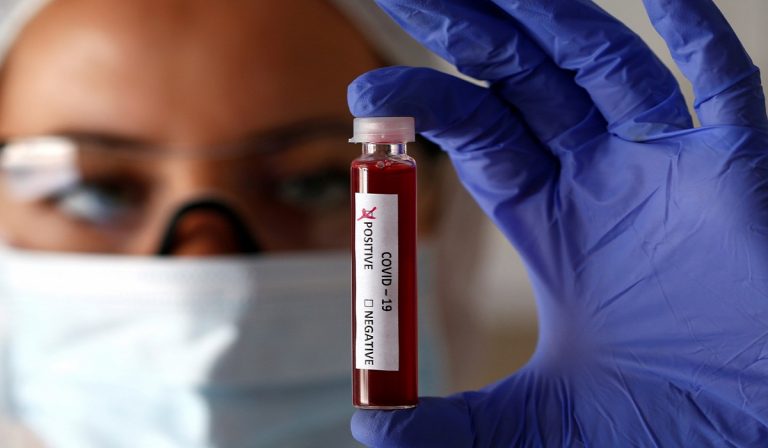Coronavirus, Italia: gli asintomatici sono tra 20 e 60%