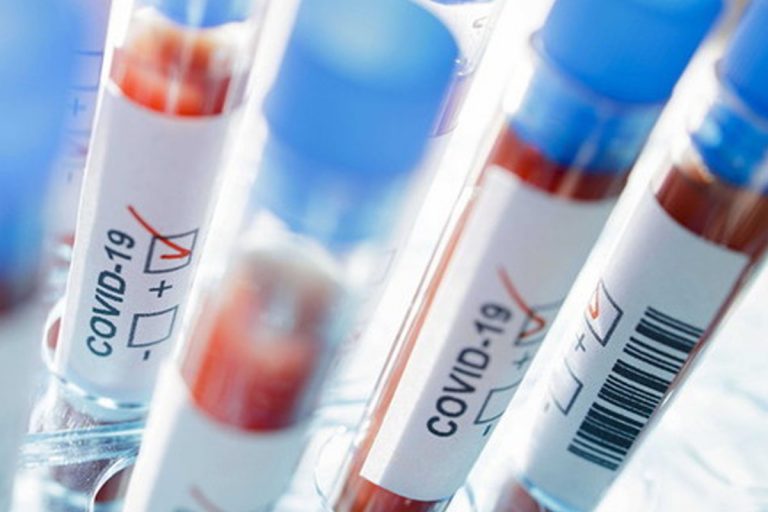 coronavirus come e dove si trasmette