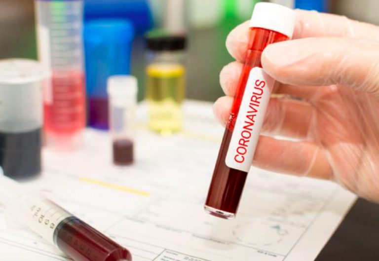 coroanvirus ceppo europeo