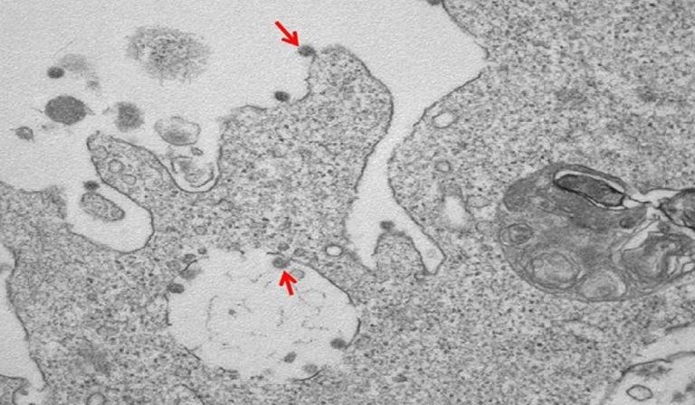 Coronavirus, prime immagini al microscopio